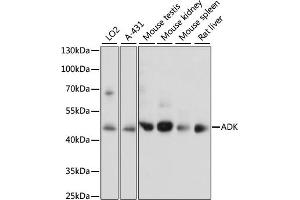 Western blot analysis of extracts of various cell lines, using ADK antibody  at 1:1000 dilution. (ADK Antikörper  (AA 200-345))