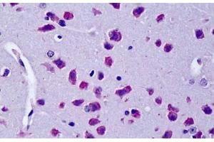ABIN190823 (5µg/ml) staining of paraffin embedded Mouse Brain. (CYLD Antikörper  (Internal Region))