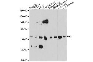 Western blot analysis of extracts of various cell lines, using HP antibody. (Haptoglobin Antikörper)