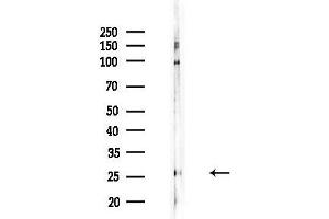 anti-Calcium Binding Protein 2 (CABP2) (Internal Region) antibody