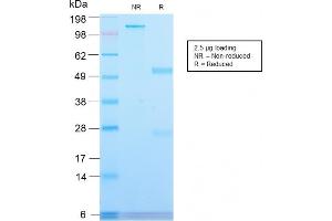 SDS-PAGE Analysis Purified CD71 Rabbit Recombinant Monoclonal Antibody (TFRC/2898R). (Rekombinanter Transferrin Receptor Antikörper  (Extracellular Domain))