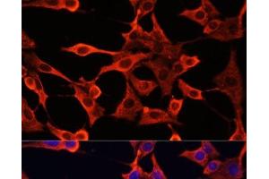 Immunofluorescence analysis of NIH/3T3 cells using TYMS Polyclonal Antibody at dilution of 1:100. (TYMS Antikörper)
