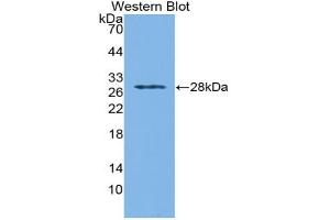 Western blot analysis of recombinant Mouse IFNa/bR1. (IFNAR1 Antikörper  (AA 104-341))