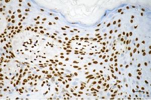 Immunohistochemistry was performed on paraffin-embedded human skin tissue using macroH2A.