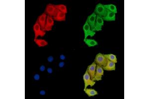 ABIN7096113 and ABIN7100175 staining Hela cells by IF/ICC. (WDR41 Antikörper)