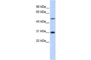 Western Blotting (WB) image for anti-Inhibitor of Growth Family, Member 3 (ING3) antibody (ABIN2458018) (ING3 Antikörper)