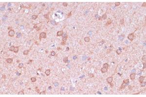 Immunohistochemistry of paraffin-embedded Rat brain using TIMM8B Polyclonal Antibody at dilution of 1:100 (40x lens).