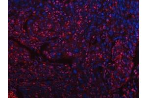 IF analysis of SART3 using anti-SART3 antibody (ABIN7600151).