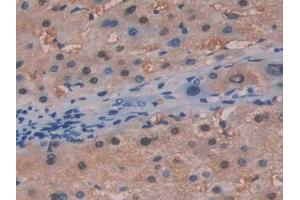 DAB staining on IHC-P; Samples: Human Liver Tissue (FAH Antikörper  (AA 189-419))