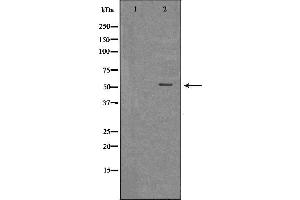 Western blot analysis of extracts of THP-1 , using MLKL antibody. (MLKL Antikörper  (Internal Region))