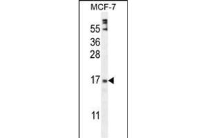 ZN Antibody (Center) (ABIN654974 and ABIN2844614) western blot analysis in MCF-7 cell line lysates (35 μg/lane). (ZNF720 Antikörper  (AA 34-62))