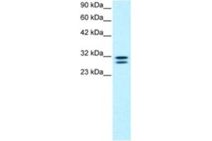 Western Blotting (WB) image for anti-HIV-1 Tat Interactive Protein 2, 30kDa (HTATIP2) antibody (ABIN2460567) (HIV-1 Tat Interactive Protein 2, 30kDa (HTATIP2) Antikörper)