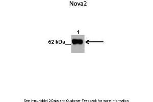 Lanes:   1. (NOVA2 Antikörper  (N-Term))