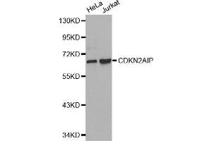 Western blot analysis of extracts of various cell lines, using CDKN2AIP antibody. (CDKN2AIP Antikörper  (AA 1-220))