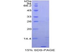 SDS-PAGE analysis of Human Apolipoprotein C1 Protein. (APOC1 Protein)