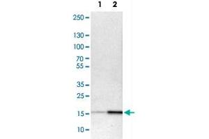 Western Blot analysis of Lane 1: NIH-3T3 cell lysate (mouse embryonic fibroblast cells) and Lane 2: NBT-II cell lysate (Wistar rat bladder tumour cells) with ACP1 polyclonal antibody . (ACP1 Antikörper)