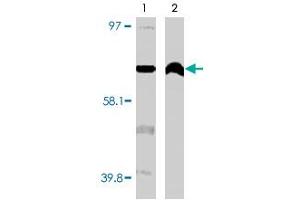 Western blot using CYP4F11 monoclonal antibody, clone F21 P6 F5  on normal (1) and cancerous (2) kidney cell lysates. (CYP4F11 Antikörper  (C-Term))