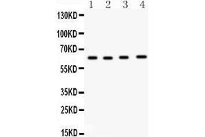 Western Blotting (WB) image for anti-Cell Division Cycle 6 Homolog (S. Cerevisiae) (CDC6) (AA 147-549) antibody (ABIN3043500) (CDC6 Antikörper  (AA 147-549))