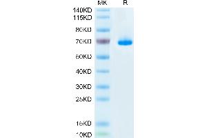 Mouse SEMA3A on Tris-Bis PAGE under reduced condition. (SEMA3A Protein (AA 21-772) (His tag))