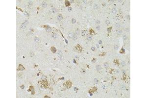 Immunohistochemistry of paraffin-embedded Mouse brain using PTPN3 Polyclonal Antibody at dilution of 1:100 (40x lens). (PTPN3 Antikörper)