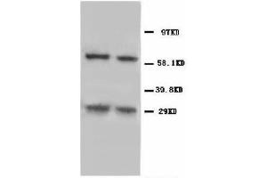 Image no. 1 for anti-BCL2/adenovirus E1B 19kDa Interacting Protein 3 (BNIP3) (N-Term) antibody (ABIN1493042) (BNIP3 Antikörper  (N-Term))