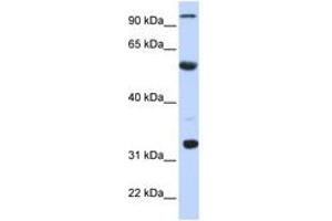 Image no. 1 for anti-Apolipoprotein B mRNA Editing Enzyme, Catalytic Polypeptide 1 (APOBEC1) (N-Term) antibody (ABIN6742971) (APOBEC1 Antikörper  (N-Term))
