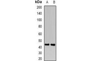 Western blot analysis of FBXO22 expression in Hela (A), MCF7 (B) whole cell lysates. (FBXO22 Antikörper)
