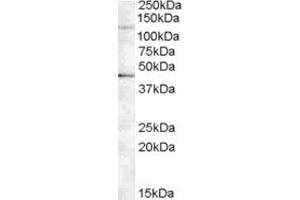 Western Blotting (WB) image for anti-Tankyrase, TRF1-Interacting Ankyrin-Related ADP-Ribose Polymerase 2 (TNKS2) (Internal Region) antibody (ABIN2466779) (TNKS2 Antikörper  (Internal Region))