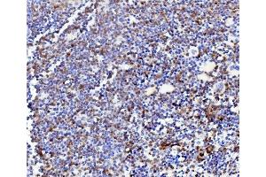 IHC analysis of NPC2 using anti-NPC2 antibody (ABIN7600520).