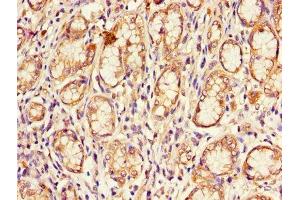 Immunohistochemistry (IHC) image for anti-Cyclin-Dependent Kinase Inhibitor 2B (p15, Inhibits CDK4) (CDKN2B) (AA 1-138) antibody (ABIN7148885)