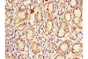 Immunohistochemistry of paraffin-embedded human stomach tissue using ABIN7148885 at dilution of 1:100 (CDKN2B Antikörper  (AA 1-138))
