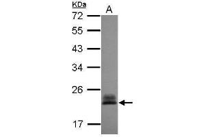 WB Image Sample (30 ug of whole cell lysate) A: A431 , 12% SDS PAGE antibody diluted at 1:3000 (RHOC Antikörper)