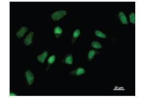 Immunostaining analysis in HeLa cells. (GATAD1 Antikörper)