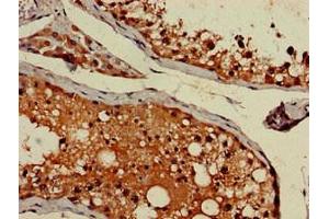 Immunohistochemistry of paraffin-embedded human testis tissue using ABIN7144346 at dilution of 1:100