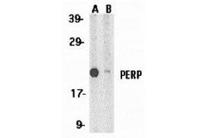 Western Blotting (WB) image for anti-TP53 Apoptosis Effector (PERP) (C-Term) antibody (ABIN1030575) (PERP Antikörper  (C-Term))