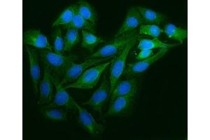 IF analysis of Astrin/Deepest/SPAG5 using anti-Astrin/Deepest/SPAG5 antibody (ABIN7602399). (SPAG5 Antikörper  (AA 738-1193))