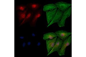 Phospho-IRF5 (Ser446) Antibody staining A549 cells(heat shock treatment) by IF/ICC. (IRF5 Antikörper  (pSer446))