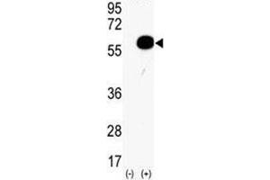 Western blot analysis of AKT2 antibody and 293 cell lysate (2 ug/lane) either nontransfected (Lane 1) or transiently transfected with the human gene (2).
