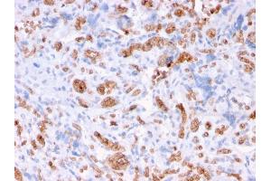 Formalin-fixed, paraffin-embedded human Placenta stained with Spectrin alpha 1 Mouse Recombinant Monoclonal Antibody (rSPTA1/1832). (Rekombinanter SPTA1 Antikörper  (AA 356-475))