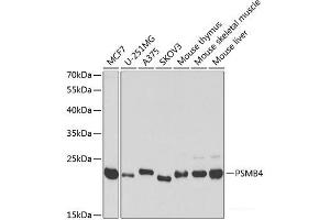 Western blot analysis of extracts of various cell lines using PSMB4 Polyclonal Antibody at dilution of 1:1000. (PSMB4 Antikörper)