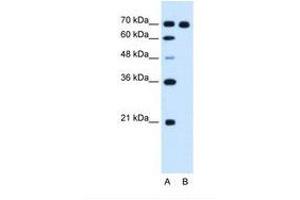 Image no. 1 for anti-Ribonucleotide Reductase M1 (RRM1) (AA 723-772) antibody (ABIN321011) (RRM1 Antikörper  (AA 723-772))