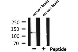 Western blot analysis of extracts from mouse brain, using E-cadherin Antibody. (E-cadherin Antikörper  (C-Term))