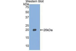 Western Blotting (WB) image for anti-Myosin, Light Chain 2, Regulatory, Cardiac, Slow (MYL2) (AA 2-159) antibody (ABIN1859939)