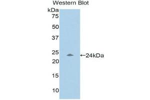 Western Blotting (WB) image for anti-Pregnancy Zone Protein (PZP) (AA 1212-1391) antibody (ABIN1176525) (PZP Antikörper  (AA 1212-1391))
