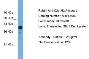 WB Suggested Anti-C2orf62  Antibody Titration: 0. (C2orf62 Antikörper  (C-Term))