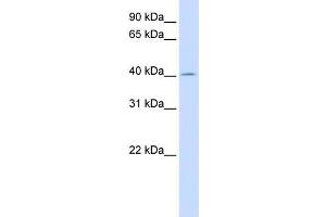Human Liver; WB Suggested Anti-ACAA2 Antibody Titration: 0. (ACAA2 Antikörper  (N-Term))