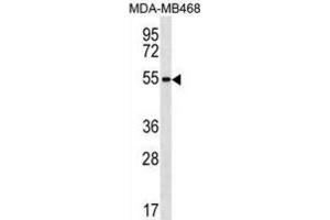 Western Blotting (WB) image for anti-Zinc Finger Protein 621 (ZNF621) antibody (ABIN3000262) (ZNF621 Antikörper)