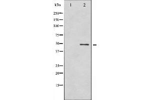 Western blot analysis of GFAP phosphorylation expression in HeLa whole cell lysates,The lane on the left is treated with the antigen-specific peptide. (GFAP Antikörper  (pSer38))