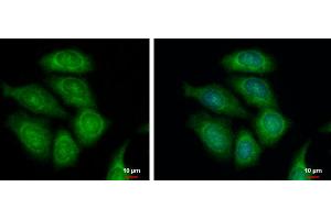 ICC/IF Image FASTKD1 antibody [C1C3] detects FASTKD1 protein at cytoplasm by immunofluorescent analysis. (FASTKD1 Antikörper)