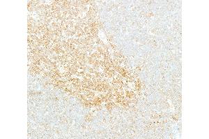 Immunohistochemistry (IHC) image for anti-Nuclear Factor-kB p65 (NFkBP65) (C-Term) antibody (ABIN7795799)